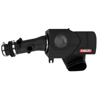 AFE Momentum Intake System w/ Pro Dry S Filter 2021+ Acura TLX