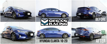 16-20 Hyundai Elantra Megan Racing Lowering Springs